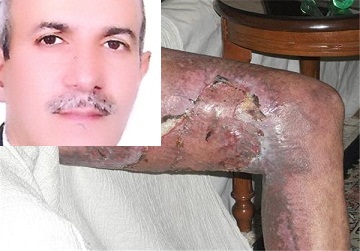 ماجرای فداکاری مرد مازندرانی برای نجات جان یک روستا/خانواده ای که انتظار خیّران و مسئولان را می کشند